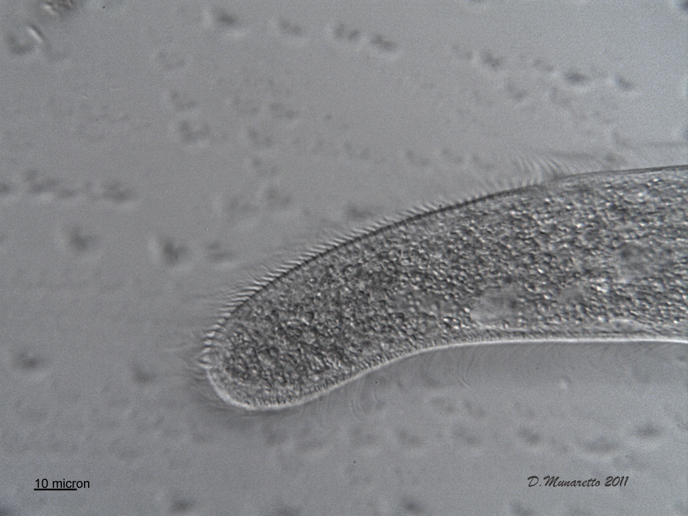 Spirostomum